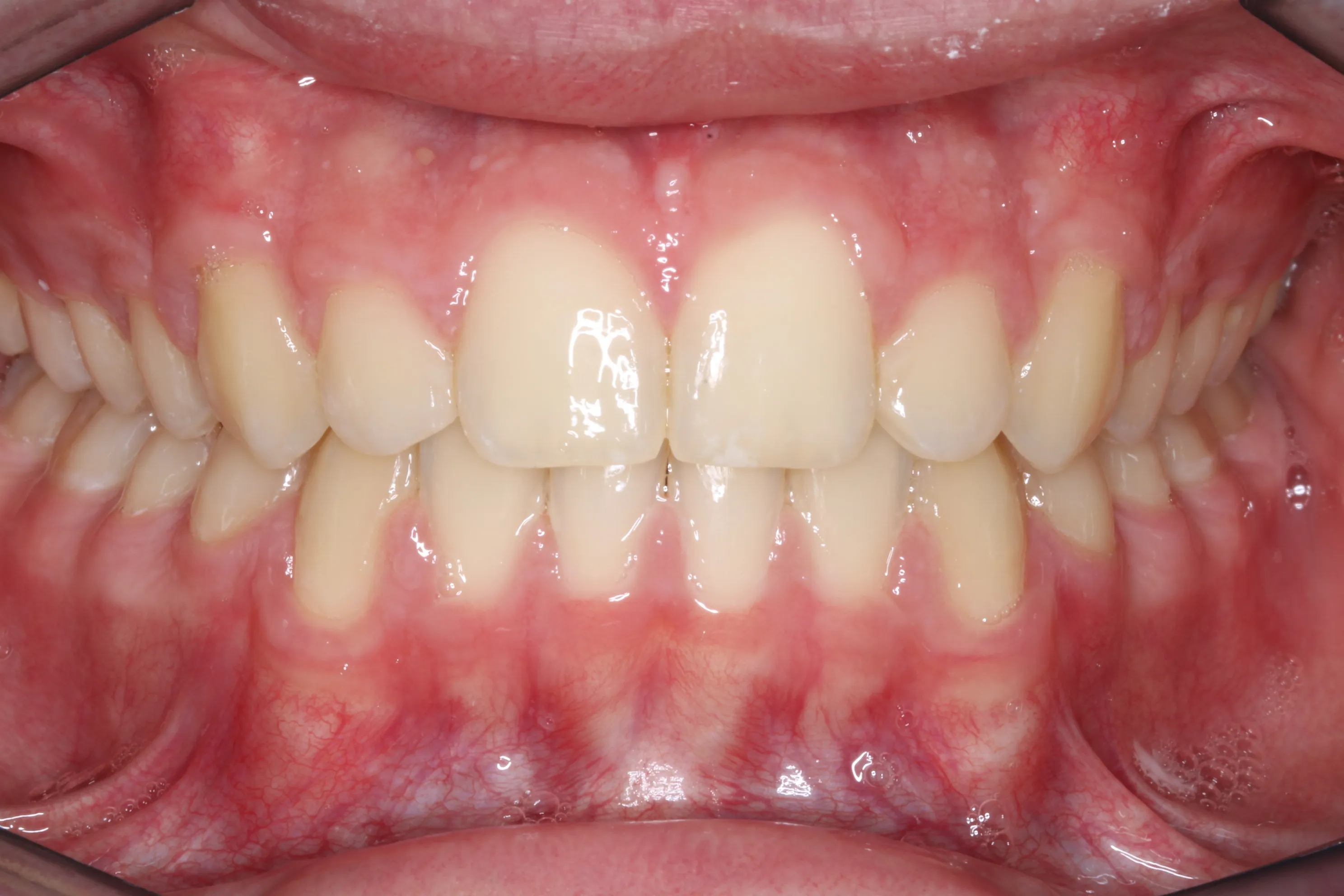 smile-gallery gallery